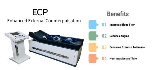 Ecp Treatment in Bangalore